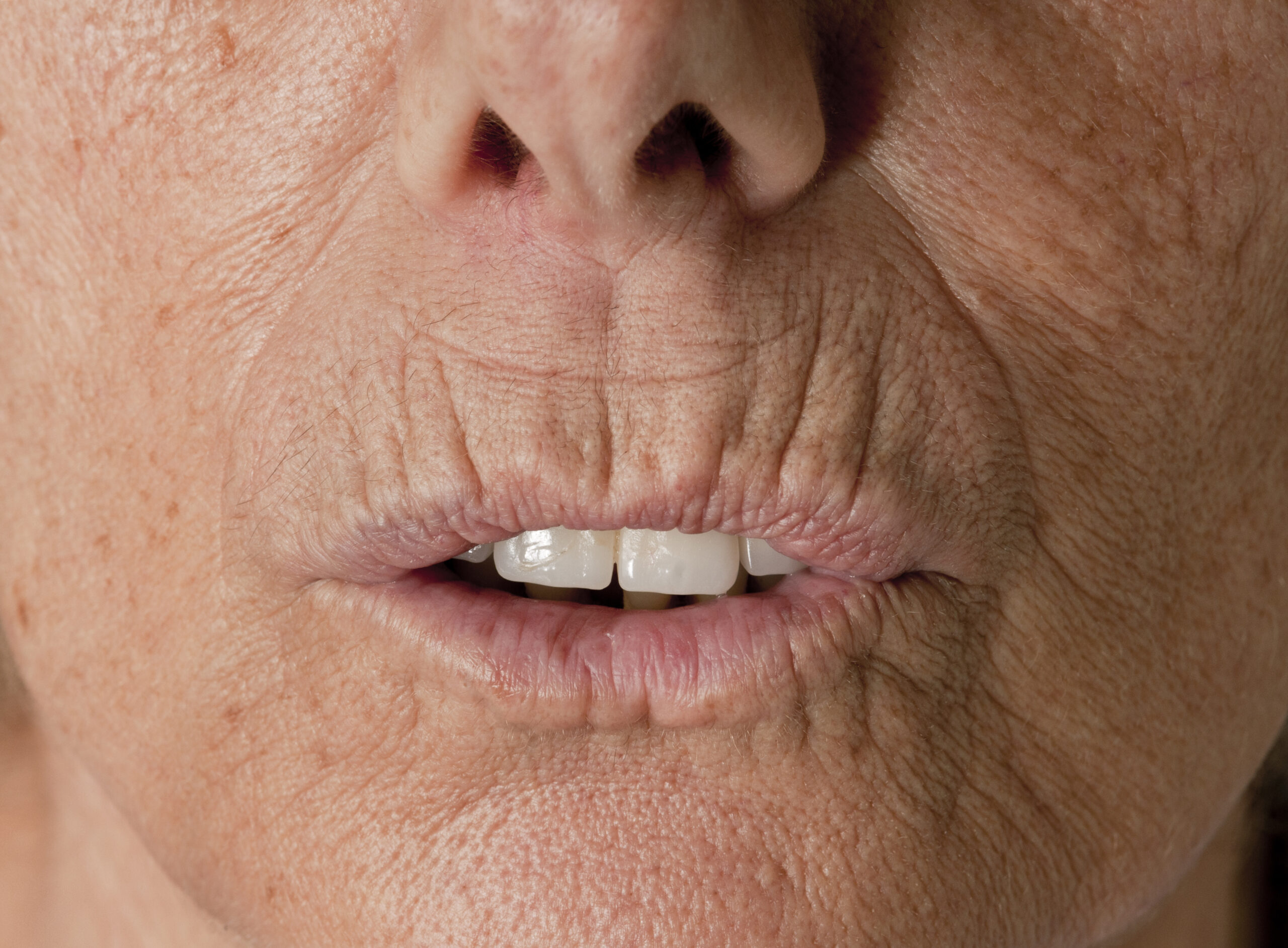 Wrinkles Examples The Truth About Wrinkles: Different Types and Their Causes - Not Mum Today