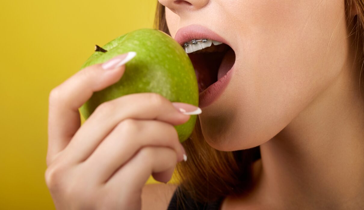 metal braces | invisible braces | invisalign
