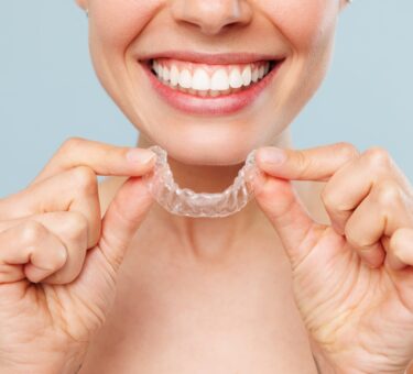 Foods to Avoid & How to Keep Invisalign in Melbourne Clear Aligners Crystal Clear | Clear Aligner Therapy Tips to Maintain an Affordable Invisalign Treatment