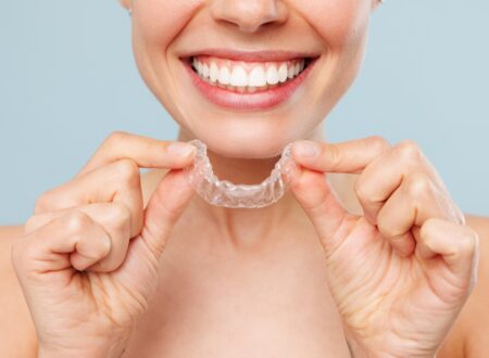 Foods to Avoid & How to Keep Invisalign in Melbourne Clear Aligners Crystal Clear | Clear Aligner Therapy Tips to Maintain an Affordable Invisalign Treatment