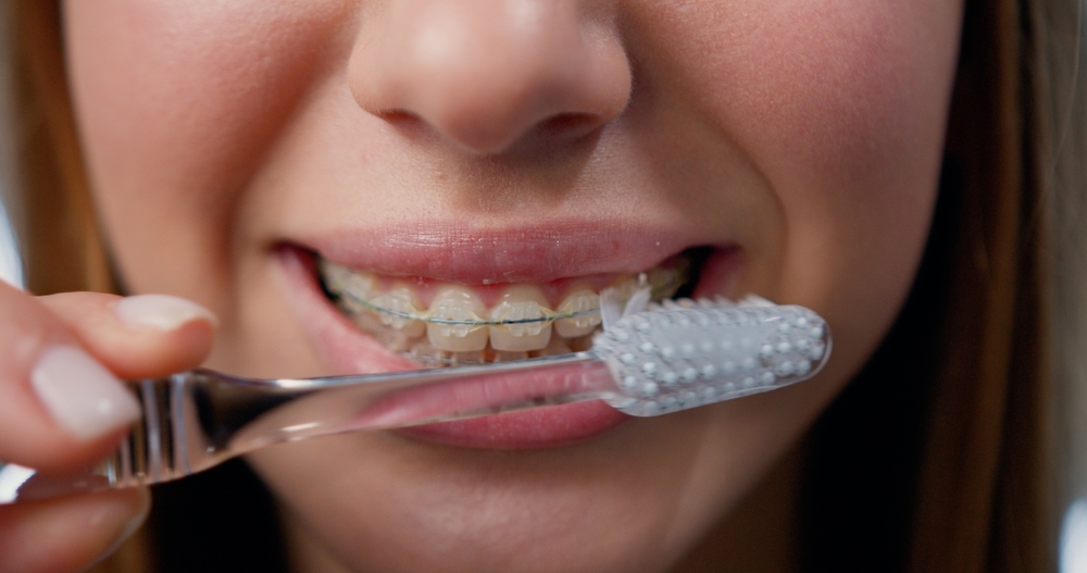 Manual vs Electric Toothbrushes for People with Braces | Oral Hygiene Tips for Adult Braces & Teen Braces in Melbourne | Metal vs Ceramic Braces Tips