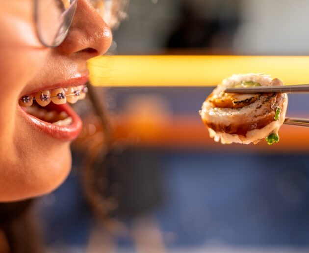 Braces-Friendly Recipes & Foods for Metal vs Ceramic Braces | Eating During Orthodontic Treatment for Braces for Adults in Melbourne & Childrens Braces