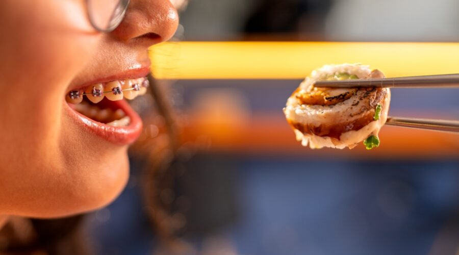 Braces-Friendly Recipes & Foods for Metal vs Ceramic Braces | Eating During Orthodontic Treatment for Braces for Adults in Melbourne & Childrens Braces