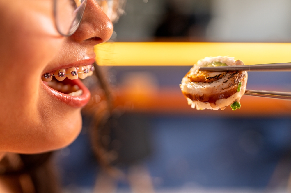 Braces-Friendly Recipes & Foods for Metal vs Ceramic Braces | Eating During Orthodontic Treatment for Braces for Adults in Melbourne & Childrens Braces