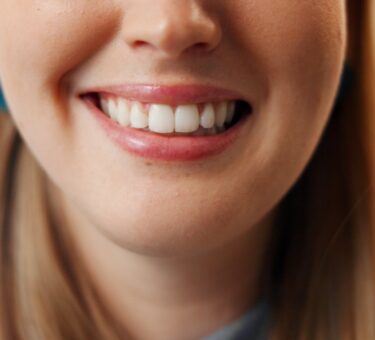 Professional Teeth Whitening vs Home Whitening Kits | Best Teeth Whitening Products | For Tooth Stains & Discolouration | Cosmetic Dentist In Darwin