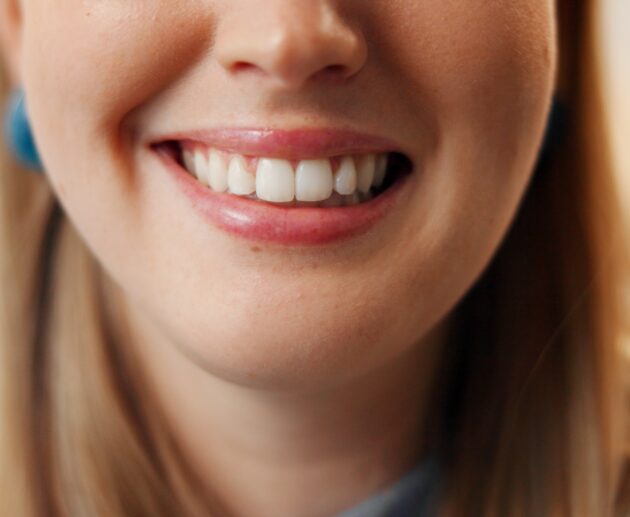 Professional Teeth Whitening vs Home Whitening Kits | Best Teeth Whitening Products | For Tooth Stains & Discolouration | Cosmetic Dentist In Darwin