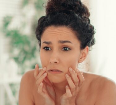 Fix Dry Skin From Hyaluronic Acid | Best Skincare Products Australia | RoC Skincare