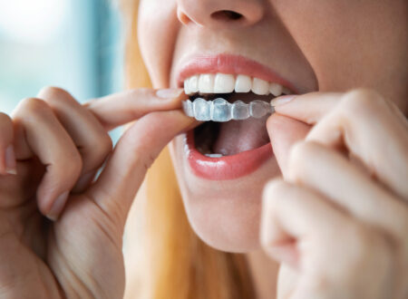 Bride preparing for her wedding while considering adult braces, aligner therapy and Invisalign for a straighter smile.