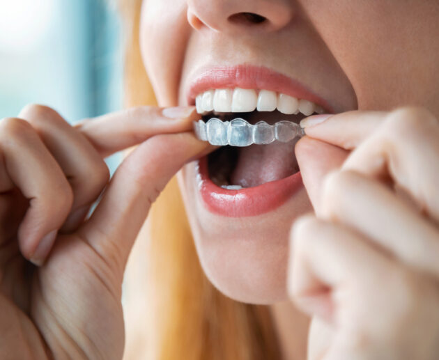 Bride preparing for her wedding while considering adult braces, aligner therapy and Invisalign for a straighter smile.