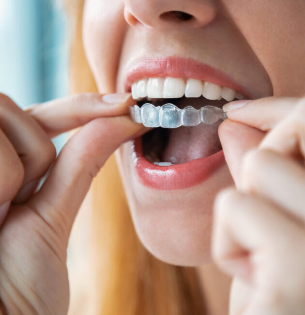 Bride preparing for her wedding while considering adult braces, aligner therapy and Invisalign for a straighter smile.