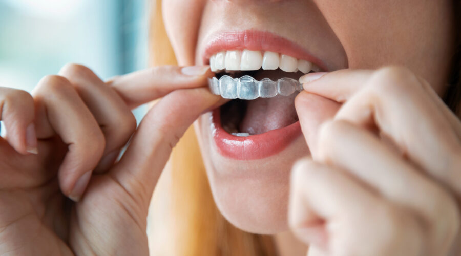 Bride preparing for her wedding while considering adult braces, aligner therapy and Invisalign for a straighter smile.